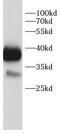 Calcium/Calmodulin Dependent Protein Kinase II Delta antibody, FNab10387, FineTest, Western Blot image 