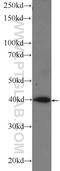 Ribosomal RNA Processing 36 antibody, 25440-1-AP, Proteintech Group, Western Blot image 