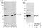 VAMP Associated Protein B And C antibody, A302-894A, Bethyl Labs, Western Blot image 