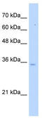 Pyrophosphatase (Inorganic) 1 antibody, TA346635, Origene, Western Blot image 