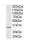 Inhibitor Of Growth Family Member 2 antibody, orb18385, Biorbyt, Western Blot image 