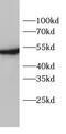 Erythropoietin Receptor antibody, FNab10436, FineTest, Western Blot image 