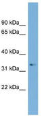 ADP Ribosylation Factor Like GTPase 13B antibody, TA340375, Origene, Western Blot image 