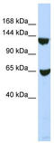 SWI/SNF Related, Matrix Associated, Actin Dependent Regulator Of Chromatin, Subfamily A, Member 1 antibody, TA335793, Origene, Western Blot image 