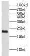 Exosome Component 1 antibody, FNab02898, FineTest, Western Blot image 