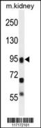 Arachidonate Lipoxygenase 3 antibody, 55-184, ProSci, Western Blot image 