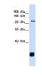 F-Box Protein 10 antibody, NBP1-79559, Novus Biologicals, Western Blot image 
