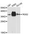 Regulator Of G Protein Signaling 2 antibody, abx127034, Abbexa, Western Blot image 