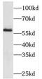 Protein Inhibitor Of Activated STAT 4 antibody, FNab06432, FineTest, Western Blot image 