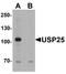 Ubiquitin Specific Peptidase 25 antibody, A06182, Boster Biological Technology, Western Blot image 