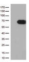 USH1C antibody, M03467, Boster Biological Technology, Western Blot image 