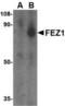 Fasciculation And Elongation Protein Zeta 1 antibody, TA306444, Origene, Western Blot image 