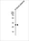 Complement C1q A Chain antibody, 61-016, ProSci, Western Blot image 