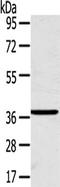 CAC antibody, TA351685, Origene, Western Blot image 