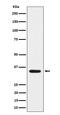 Sphingolipid delta(4)-desaturase DES1 antibody, M05502, Boster Biological Technology, Western Blot image 