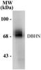 Dopamine Beta-Hydroxylase antibody, NB300-112, Novus Biologicals, Western Blot image 