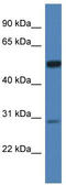 Iduronate 2-Sulfatase antibody, TA343089, Origene, Western Blot image 