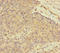 Uveal Autoantigen With Coiled-Coil Domains And Ankyrin Repeats antibody, LS-C676670, Lifespan Biosciences, Immunohistochemistry paraffin image 