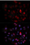 ABL Proto-Oncogene 1, Non-Receptor Tyrosine Kinase antibody, MBS125134, MyBioSource, Immunofluorescence image 
