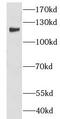 Leucine Zipper Protein 1 antibody, FNab04891, FineTest, Western Blot image 