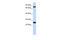 Zinc Finger Protein 799 antibody, 25-346, ProSci, Western Blot image 
