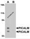 Phosphatidylinositol Binding Clathrin Assembly Protein antibody, 5553, ProSci, Western Blot image 