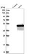 Mevalonate Kinase antibody, HPA016961, Atlas Antibodies, Western Blot image 