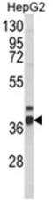 Peroxisomal 3,2-trans-enoyl-CoA isomerase antibody, AP18149PU-N, Origene, Western Blot image 