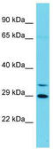 Cyclin Y Like 1 antibody, TA334917, Origene, Western Blot image 