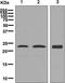 Inducible T Cell Costimulator antibody, ab133680, Abcam, Western Blot image 