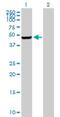 Phosphatidylinositol-5-Phosphate 4-Kinase Type 2 Gamma antibody, H00079837-B01P, Novus Biologicals, Western Blot image 