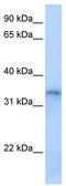 Four and a half LIM domains protein 5 antibody, TA339239, Origene, Western Blot image 