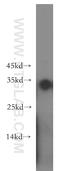 N(Alpha)-Acetyltransferase 15, NatA Auxiliary Subunit antibody, 19188-1-AP, Proteintech Group, Western Blot image 