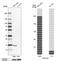 NADH:Ubiquinone Oxidoreductase Subunit A7 antibody, PA5-63693, Invitrogen Antibodies, Western Blot image 