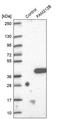 Uncharacterized protein C1orf183 antibody, PA5-55697, Invitrogen Antibodies, Western Blot image 