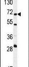5'-Nucleotidase, Cytosolic IB antibody, PA5-23805, Invitrogen Antibodies, Western Blot image 