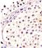 Developmental pluripotency-associated protein 4 antibody, A10283-2, Boster Biological Technology, Immunohistochemistry paraffin image 