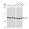 P21 (RAC1) Activated Kinase 2 antibody, GTX02856, GeneTex, Western Blot image 