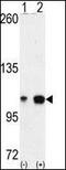 EPH Receptor A4 antibody, PA1-30293, Invitrogen Antibodies, Western Blot image 