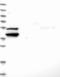 Cancer susceptibility candidate protein 1 antibody, NBP1-83810, Novus Biologicals, Western Blot image 