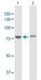 Probable histone-lysine N-methyltransferase NSD2 antibody, H00007468-B01P, Novus Biologicals, Western Blot image 