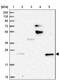 StAR Related Lipid Transfer Domain Containing 5 antibody, NBP1-92448, Novus Biologicals, Western Blot image 