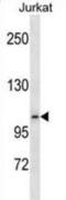 Ephrin type-B receptor 6 antibody, abx031007, Abbexa, Western Blot image 