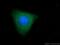 Protein Tob2 antibody, 13607-1-AP, Proteintech Group, Immunofluorescence image 
