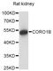 Coronin 1B antibody, A14593, ABclonal Technology, Western Blot image 