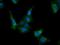 Caseinolytic Mitochondrial Matrix Peptidase Proteolytic Subunit antibody, GTX84679, GeneTex, Immunocytochemistry image 