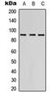 Adhesion G Protein-Coupled Receptor E2 antibody, LS-C356014, Lifespan Biosciences, Western Blot image 