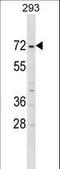 ZFP69 Zinc Finger Protein B antibody, LS-C157486, Lifespan Biosciences, Western Blot image 