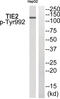 TEK Receptor Tyrosine Kinase antibody, 79-867, ProSci, Western Blot image 