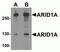 AT-Rich Interaction Domain 1A antibody, NBP2-81795, Novus Biologicals, Western Blot image 